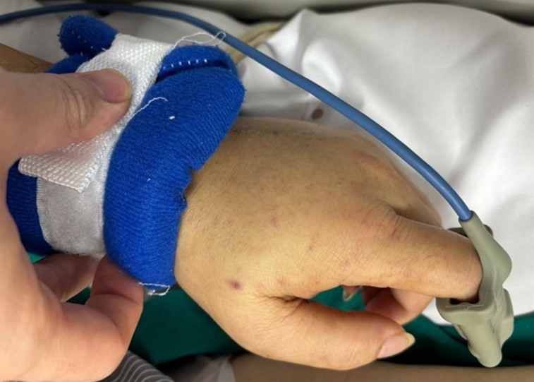 B:ệnh viện Bạch Mai phát cảnh b:á:o về 1 căn bệnh ng:u:y hiể:m, lây lan nhanh, tỷ lệ tuvong cao